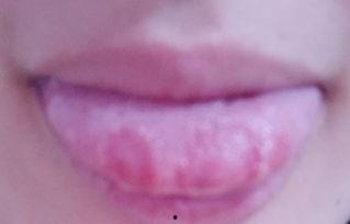 吃瓜舌头光烂吗,揭秘光鲜外表下的真相与烂底